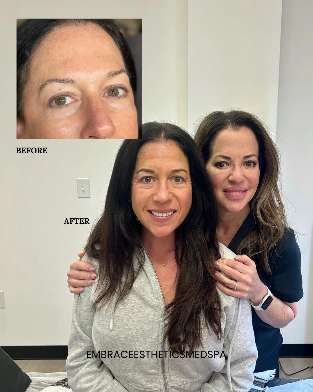 Brows can change everything ✨ (INKD Beauty Tulsa )

This before &amp; after highlights the power of eyebrow tattooing when it&rsquo;s done with intention. Soft, natural strokes designed to restore shape, add fullness, and frame the face without looki