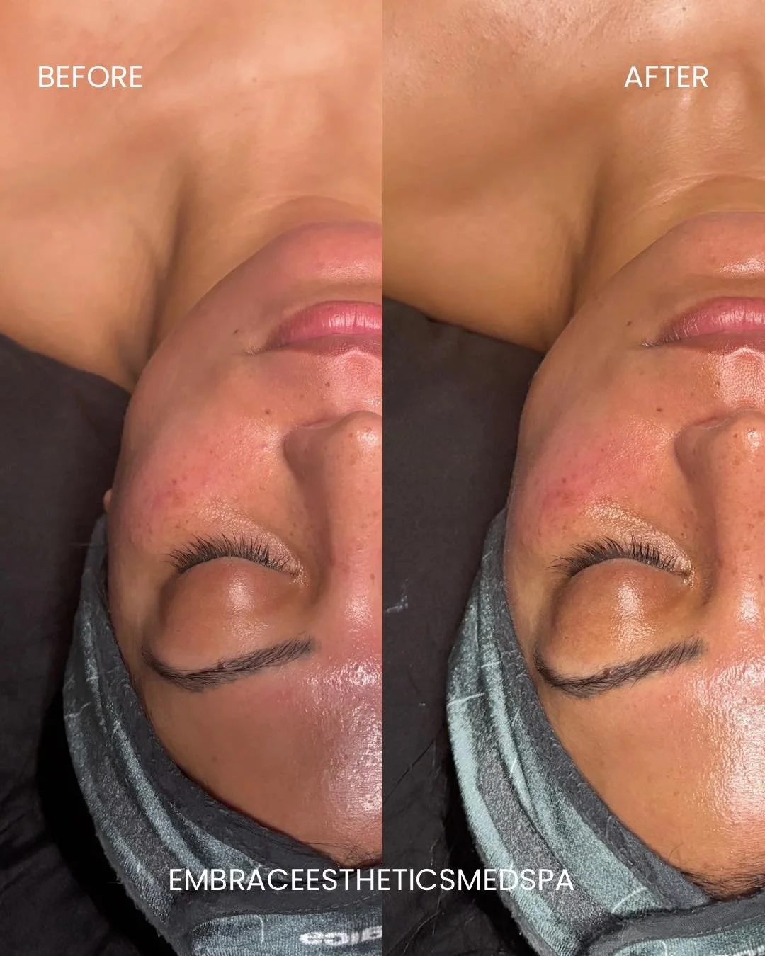 This is the Pro60 Facial with our esthetician Reina ( @reinewesthetics___ ) fully customized, results-driven, and zero fluff. Just real skin work.

Deep cleanse. Targeted exfoliation. Professional-grade products. Intentional treatment time.

Whether 