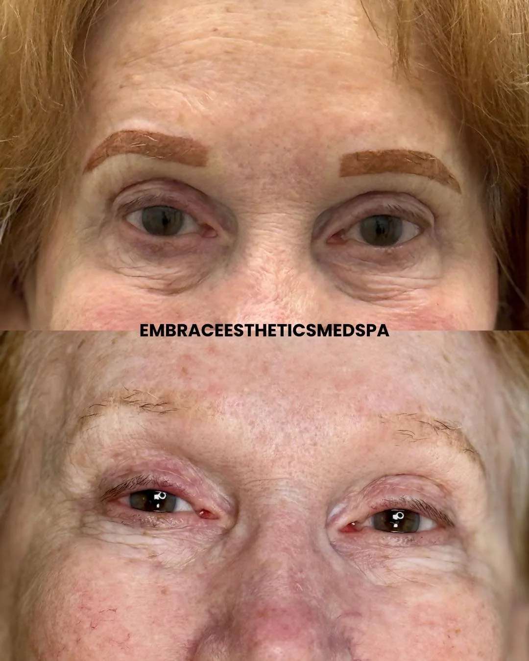 Brows that wake up ready with you.

These beautiful PMU brows by Elyssa ( @inkdbeautytulsa )were designed to enhance this client&rsquo;s natural features while giving her soft, balanced, effortless definition every single day.

Permanent makeup is pe