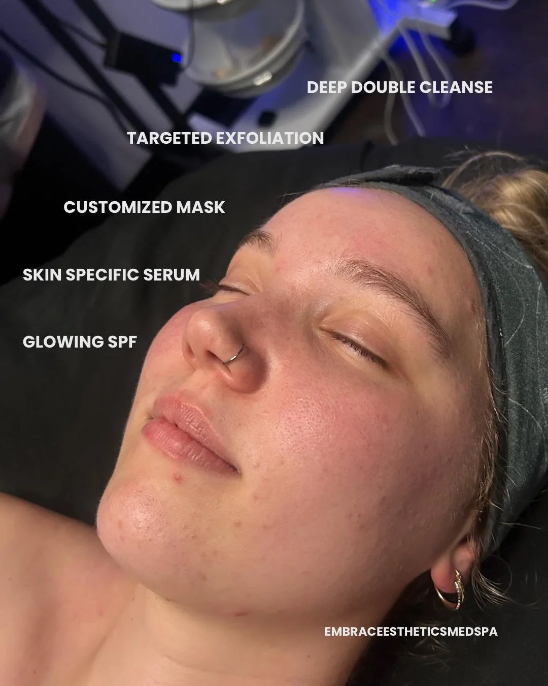 Healthy skin starts with the right foundation. ✨

This beautiful Pro30 facial by our esthetician Nicole (emerald.esthetics.co )included a deep double cleanse, targeted exfoliation, a customized mask, skin-specific serums, and glowing SPF to leave thi
