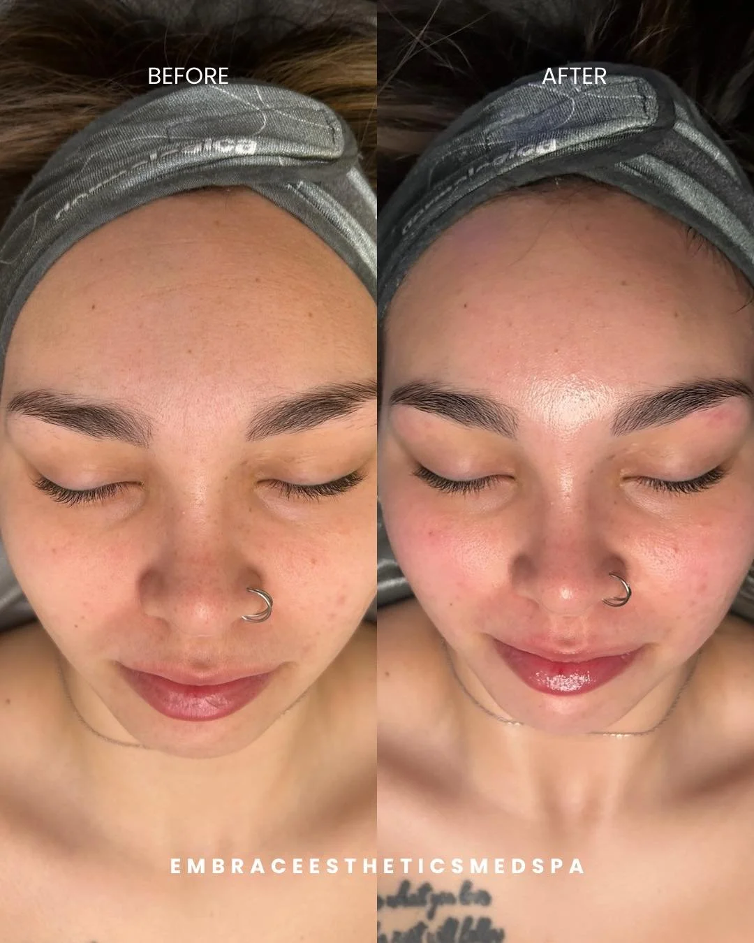 This is what happens when you book a facial with Nicole (emerald.esthetics.co ) DON&rsquo;T SAY WE DIDN&rsquo;T WARN YOU! 

Our estheticians don&rsquo;t just perform the service, they help you understand your skin, what it needs, and what products wi