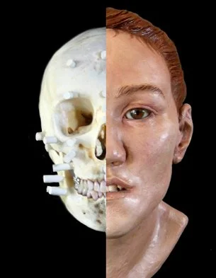 Basic 3D Facial Reconstruction.jpeg