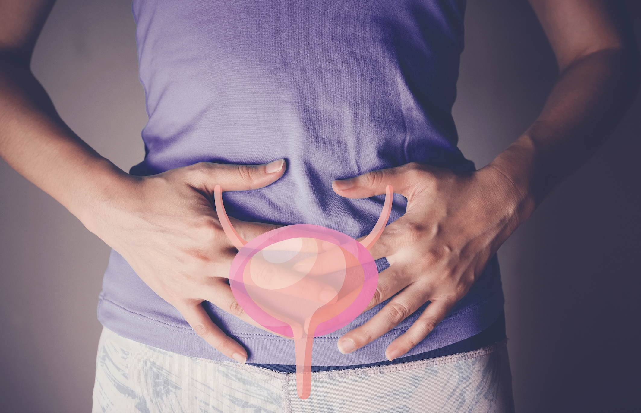 Urinary incontinence