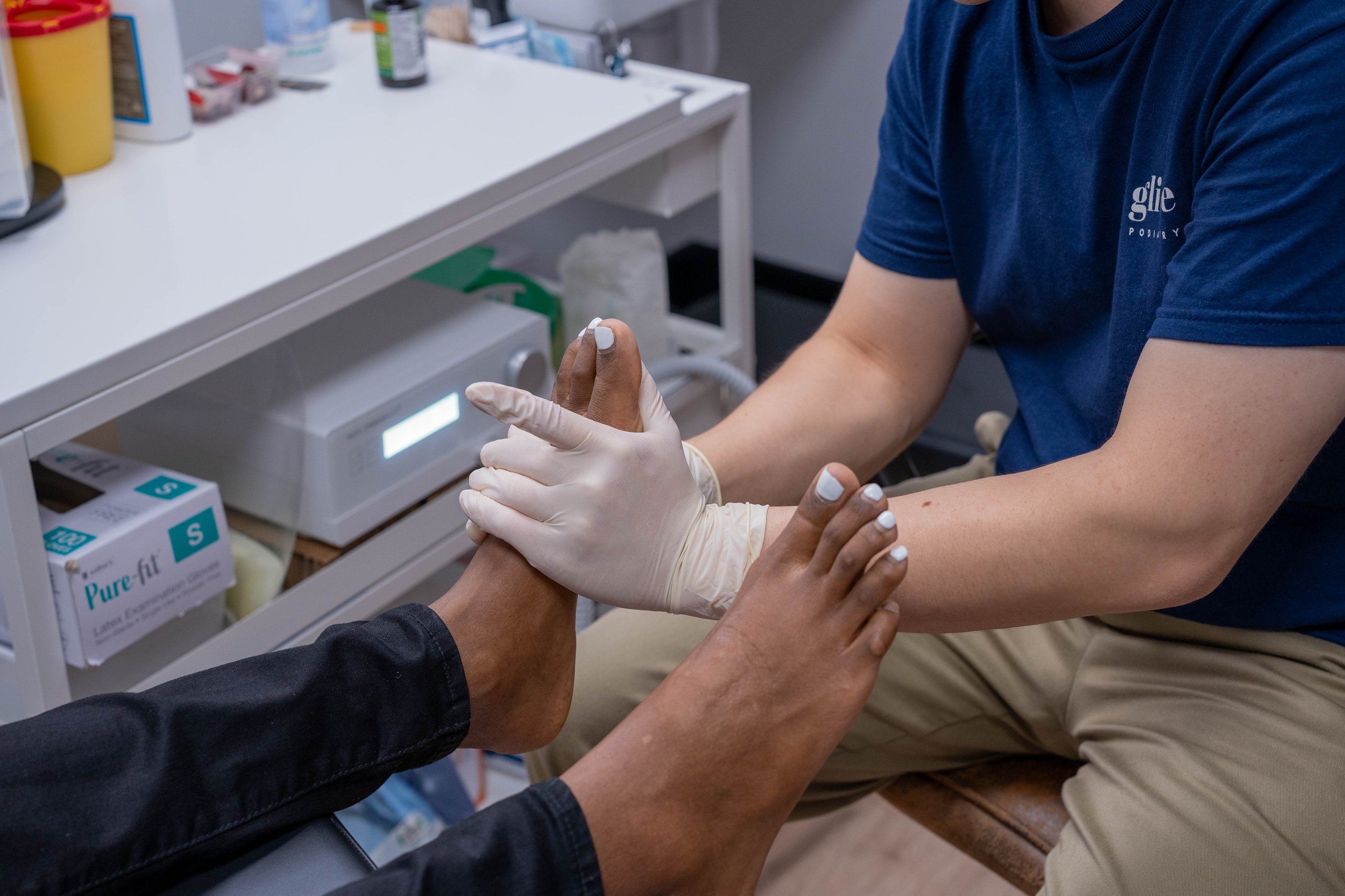 Professional podiatrist treating ingrown toenail and nail problems - Glide Podiatry Queensland foot care specialist providing toenail treatment for painful ingrown nails and fungal infections