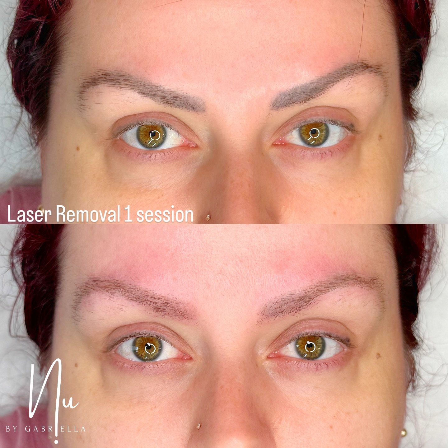 💞 The re fresh you sometimes need in PMU that no one tells you about 

I love that my client recognised that she needed to remove the old to start fresh again with a new set of brows. In her case you can see the ink is flying out the most important 