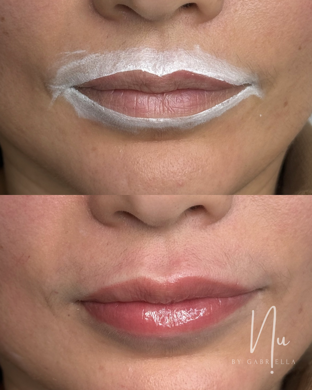 112 lips b4&after - 3.PNG