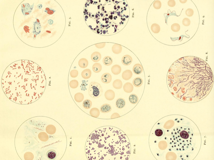 So You Think You Need A Parasite Cleanse