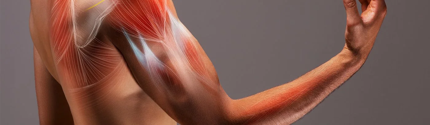 Bicep Tendinitis