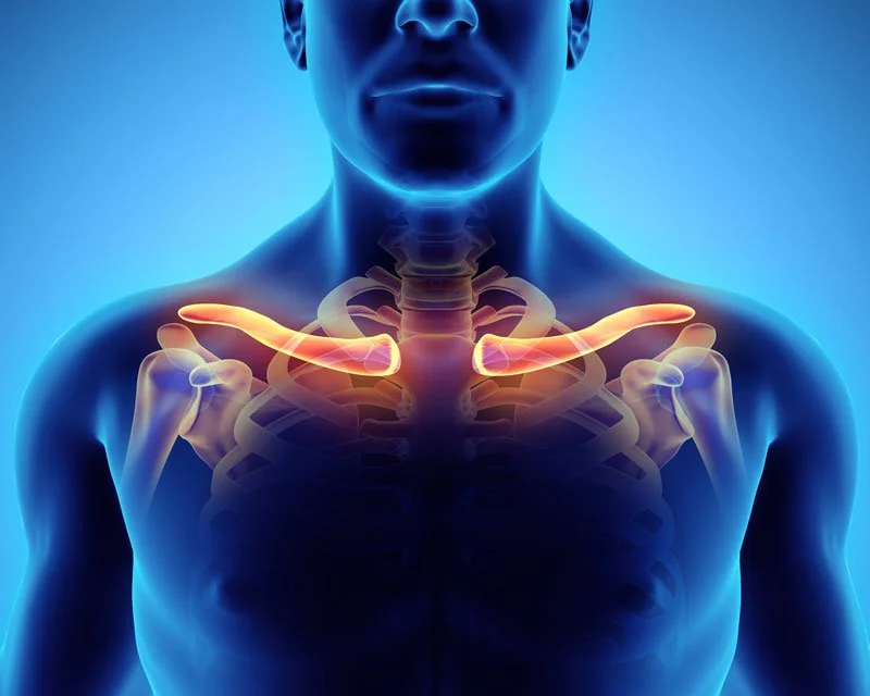 Thoracic Outlet Syndrome