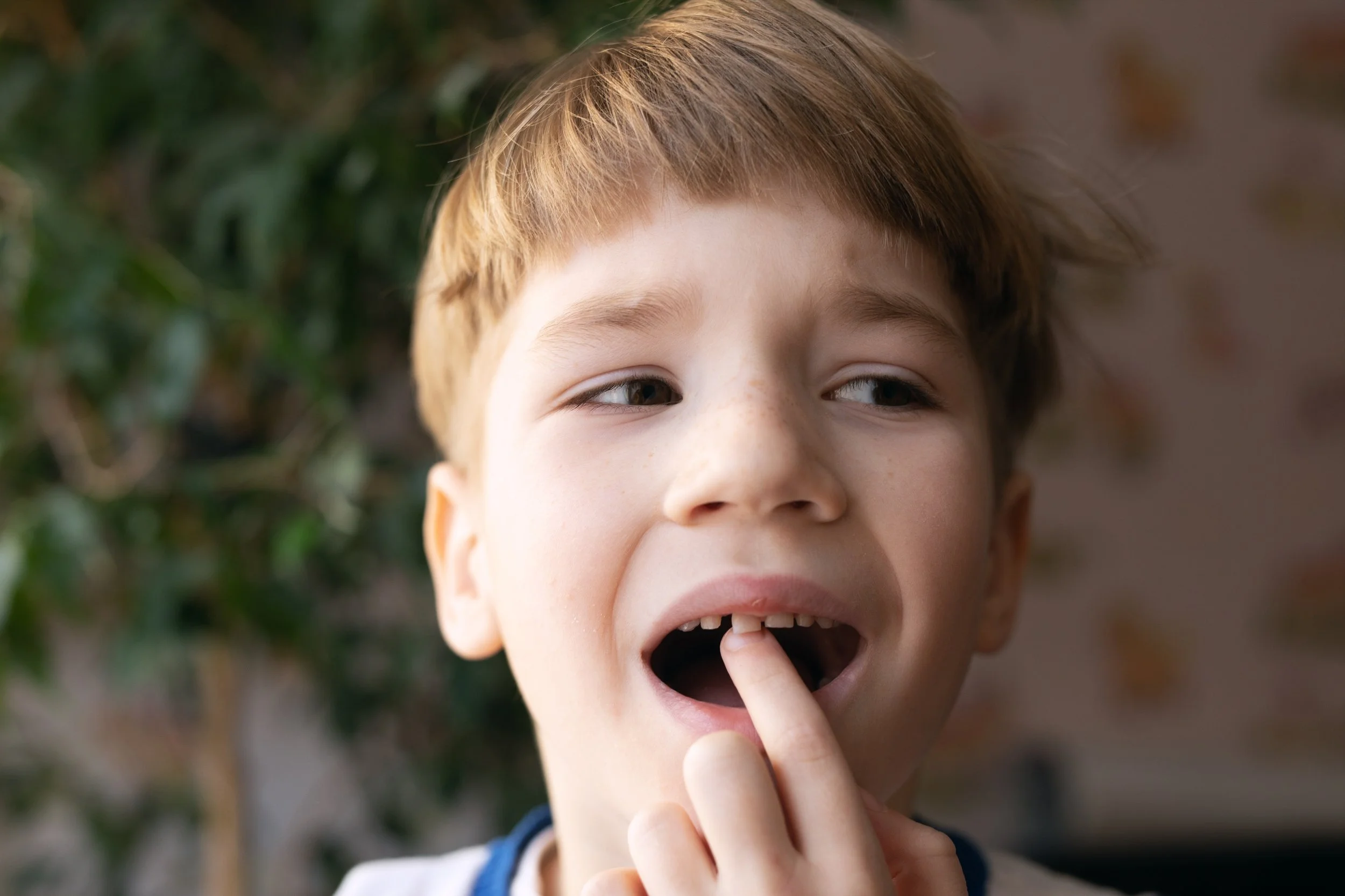 Knocked-Out Tooth on the Sports Field: What to Do in the First 10 Minutes 