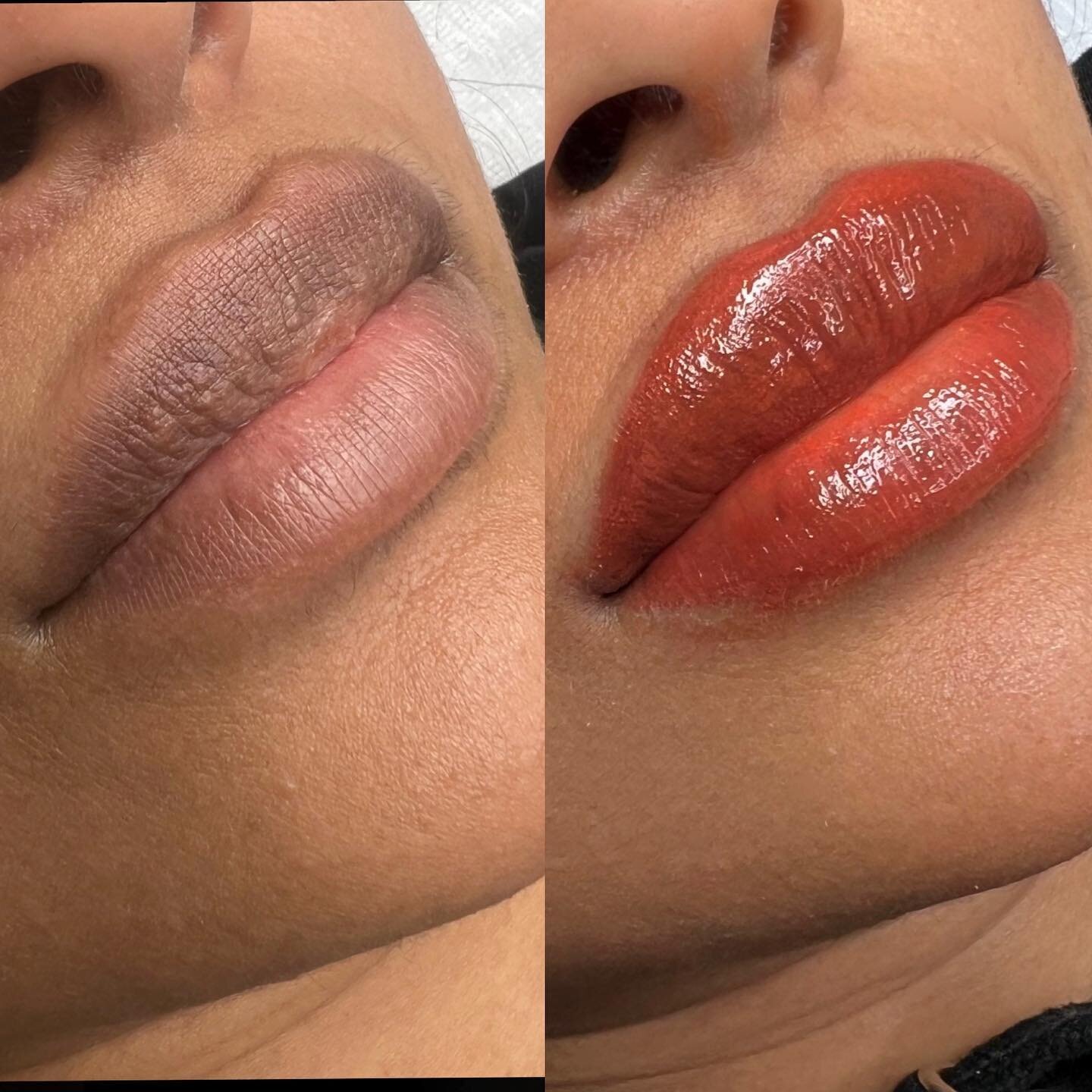 Let&rsquo;s talk Dark Lip Neutralization! What is it? It&rsquo;s a specialized treatment for those with cool or dark lips. In which yellow, orange or reddish orange ink is used to neutralize the darkness in the lips to reach a desired color. We look 