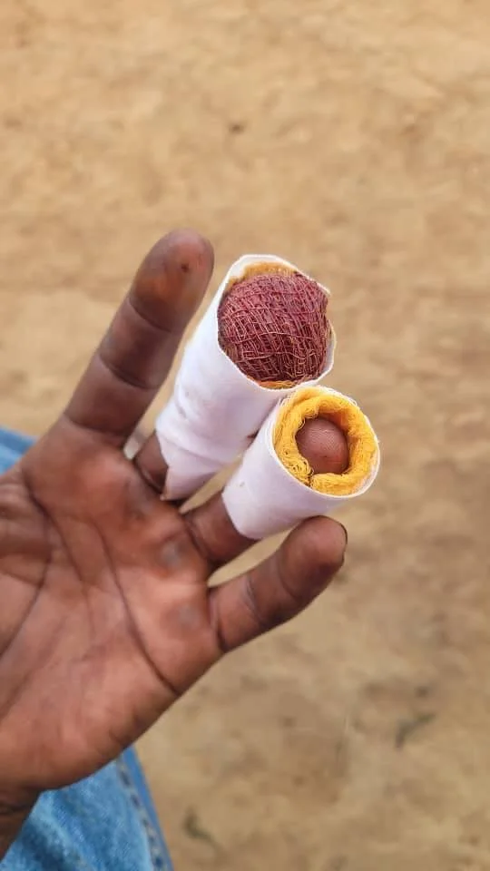 I told Wilobo Simon Peter not to put his fingers in the fan blade of the mower, but he couldn&rsquo;t resist! Ha. Jokes aside, injuries like this in rural Uganda with no health clinic nearby are no joke. Please keep Simon in your prayers as he heals 