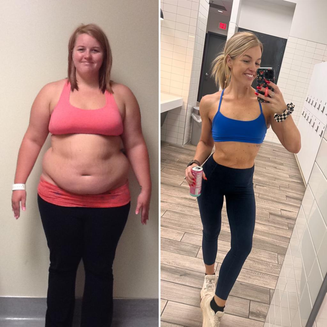 You deserve to be a successful bariatric patient!
