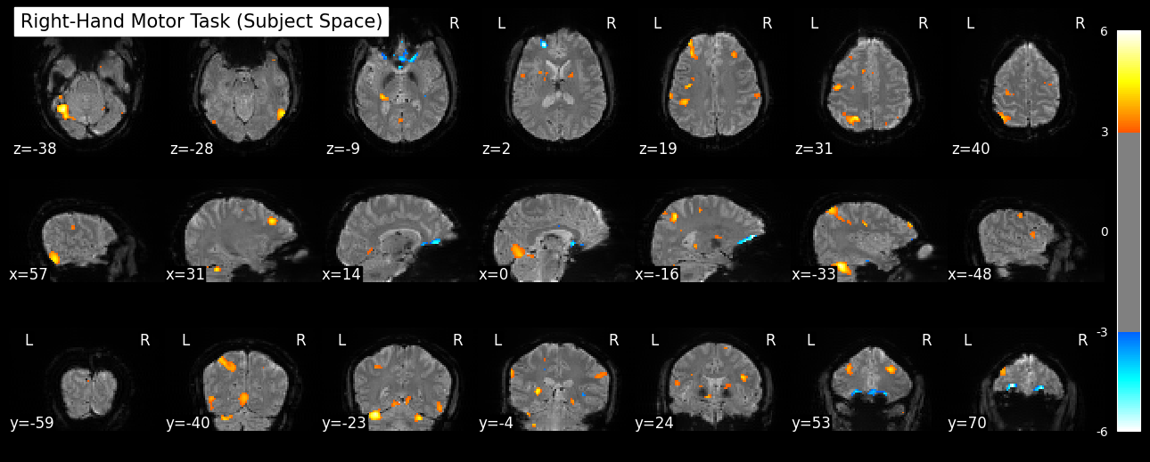 a quick look at my fmri