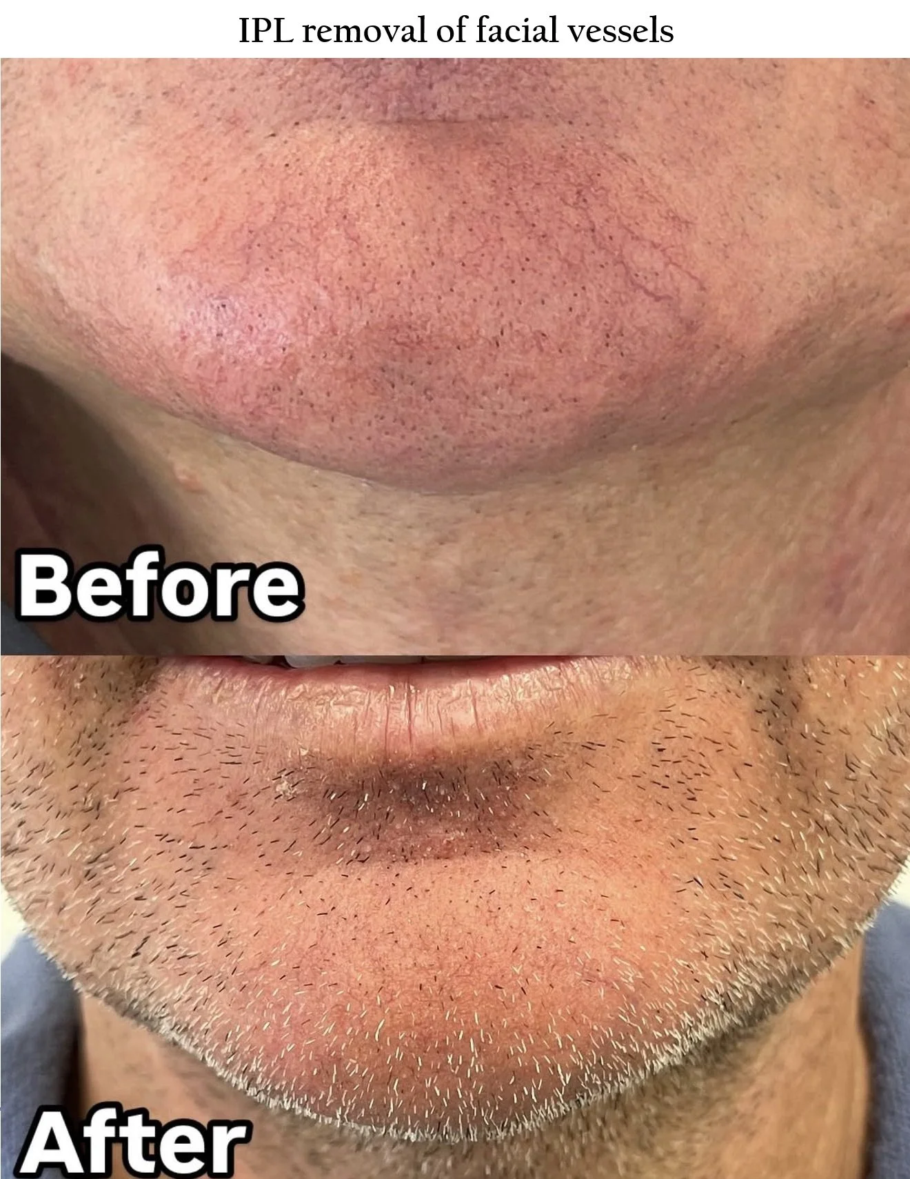 Facial vessels.jpg