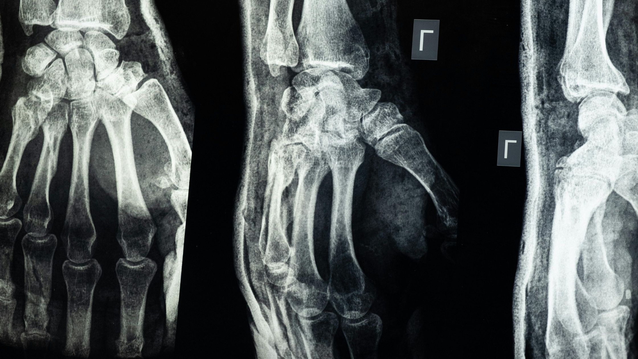 Returning to work after illness or injury