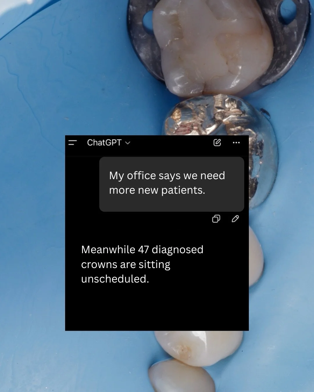 Dentistry version of &ldquo;things we say instead of addressing the actual problem.&rdquo; 

And before everyone gets defensive, relax. I&rsquo;ve said some of these too. That&rsquo;s probably why they&rsquo;re funny.

Most practice bottlenecks aren&