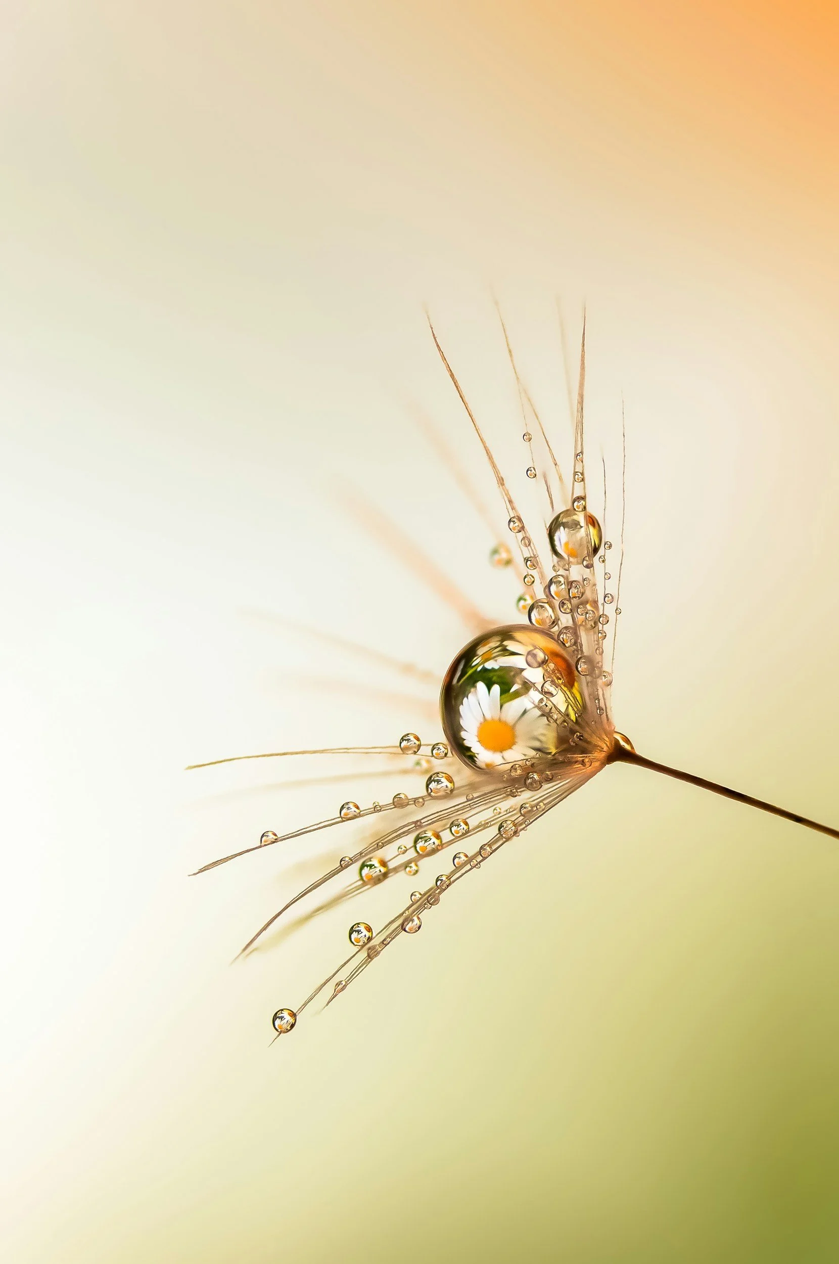 How does Acupuncture treat Pain?