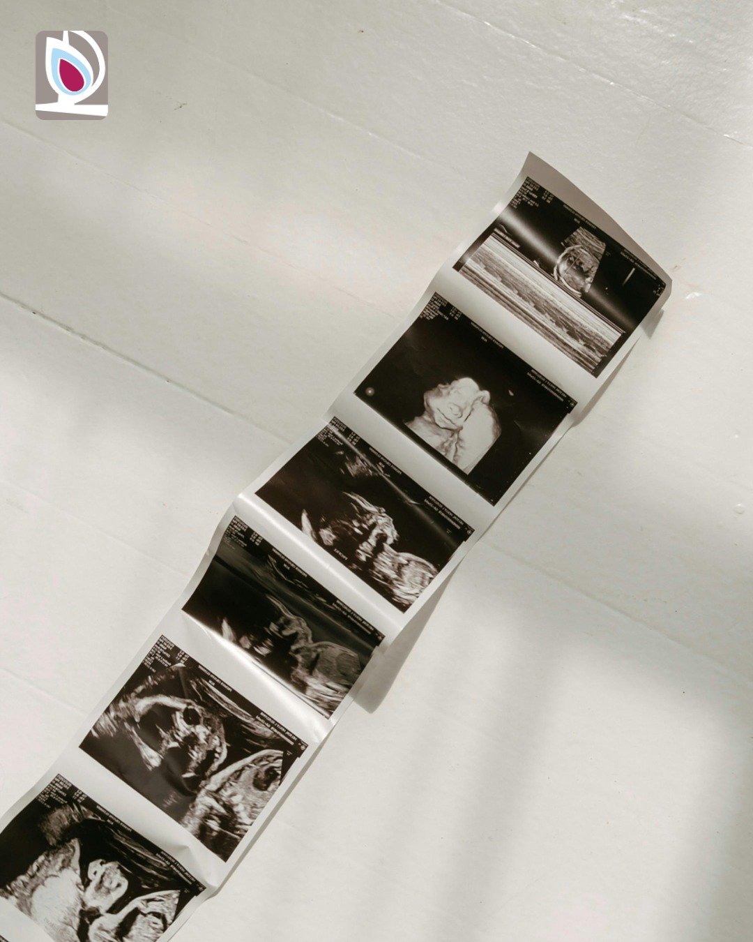 Did you know?

An ultrasound gives key medical details &mdash; like how far along a pregnancy is &mdash; but your feelings don&rsquo;t have to be figured out all at once.

Take your time. Ask questions. You&rsquo;re not alone. 💛

#DidYouKnow #Suppor