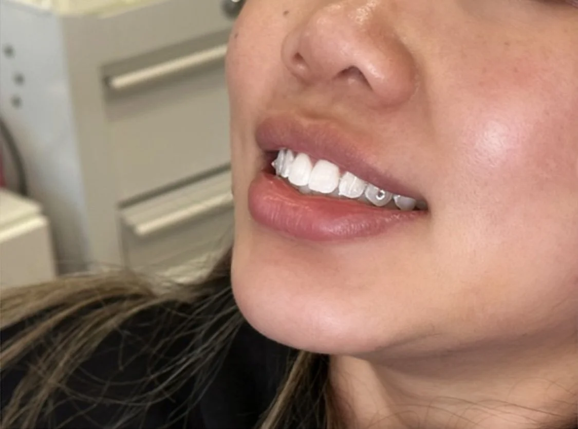 POSTED FOR ON GH FEED.JPG