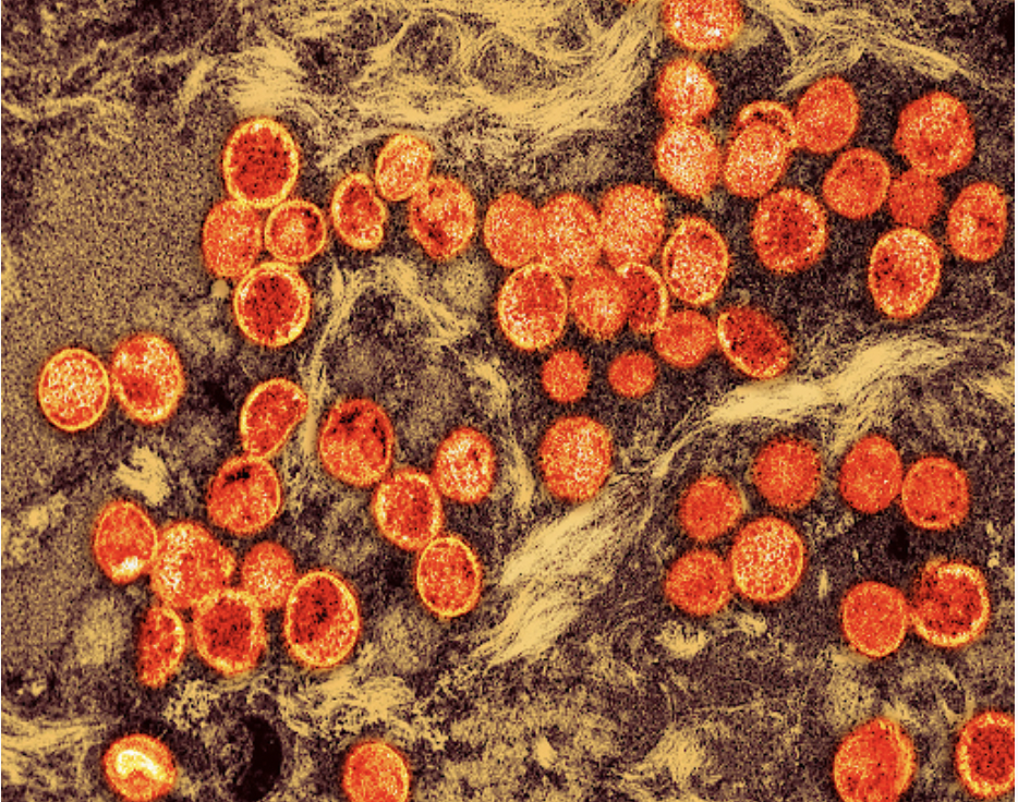 Exploring First-World Ignorance of Monkeypox