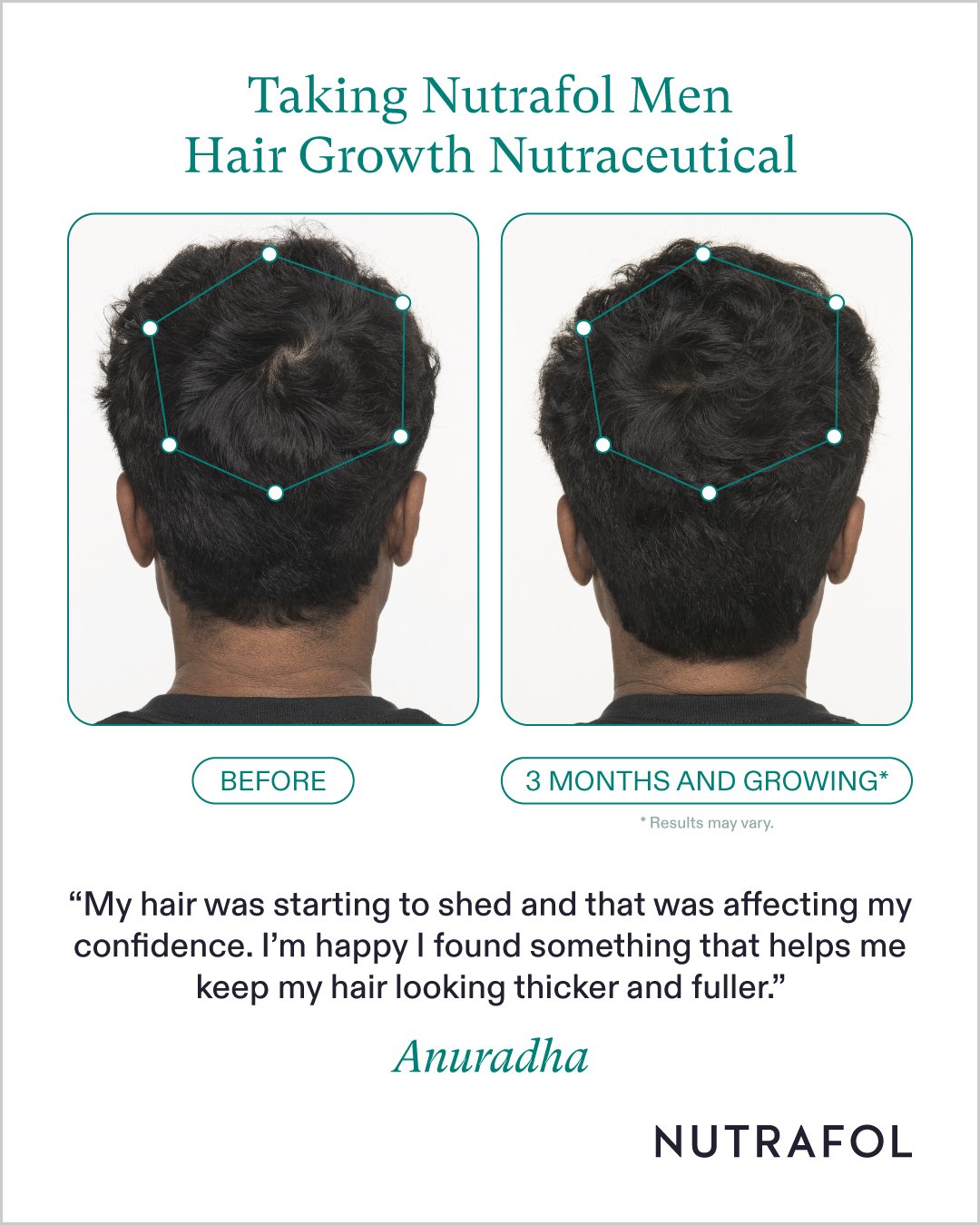 Nutrafol_Before_After_Photo_Anuradha-1.jpg