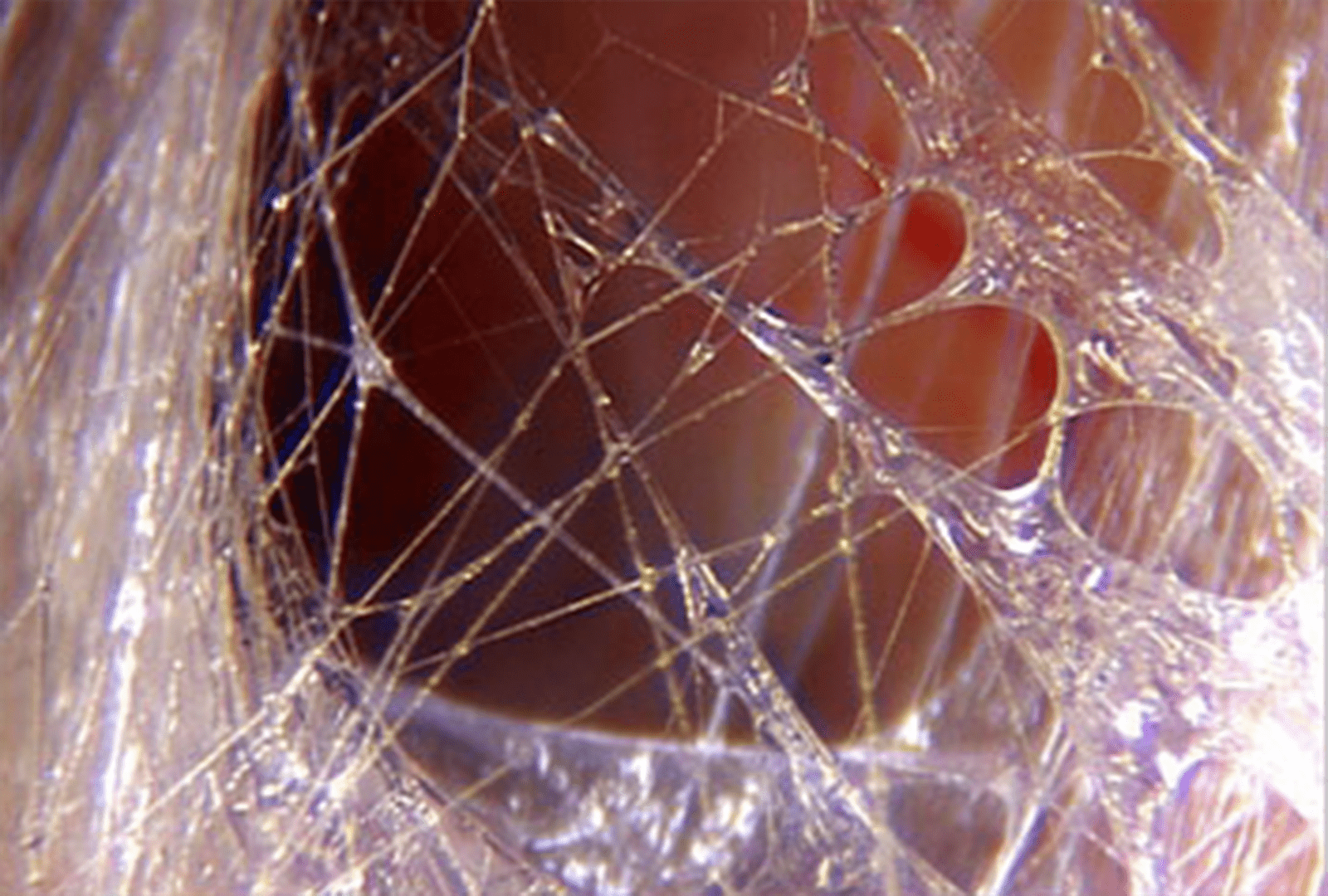 Fascia: The Hidden Web That Shapes Our Mobility, Our Pain, and Our Healing
