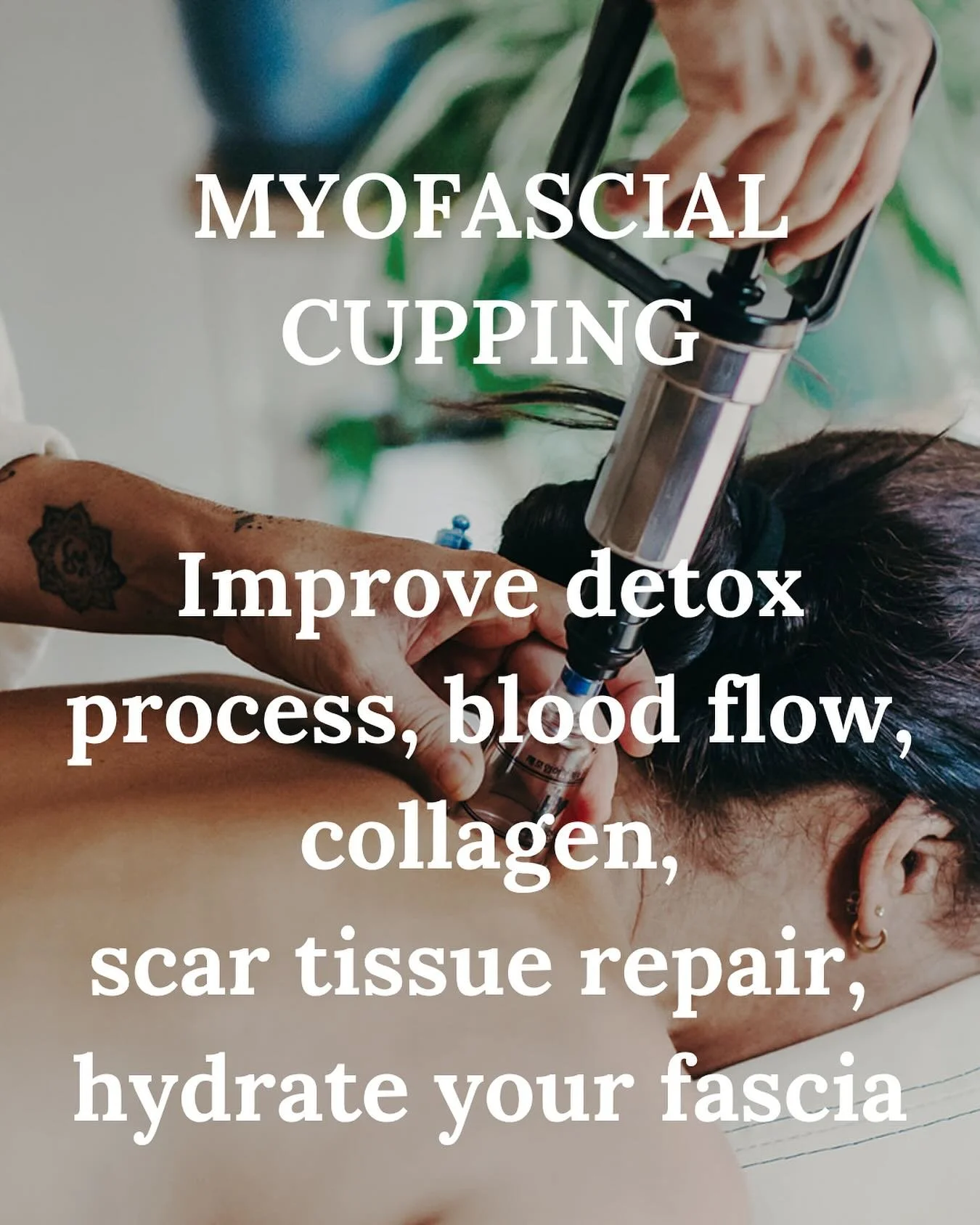 Myofacial cupping is an incredible modality with noticeable and effective results. It increases the range of motion in the joints. Dissolve fascia adhesion, improve the skin structure where there is scar tissues and scars. It brings back hydration an
