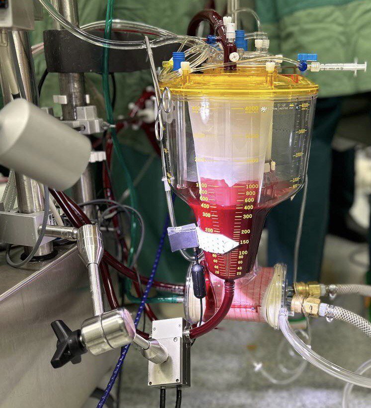Sensors+in+use+heart+institute.jpeg