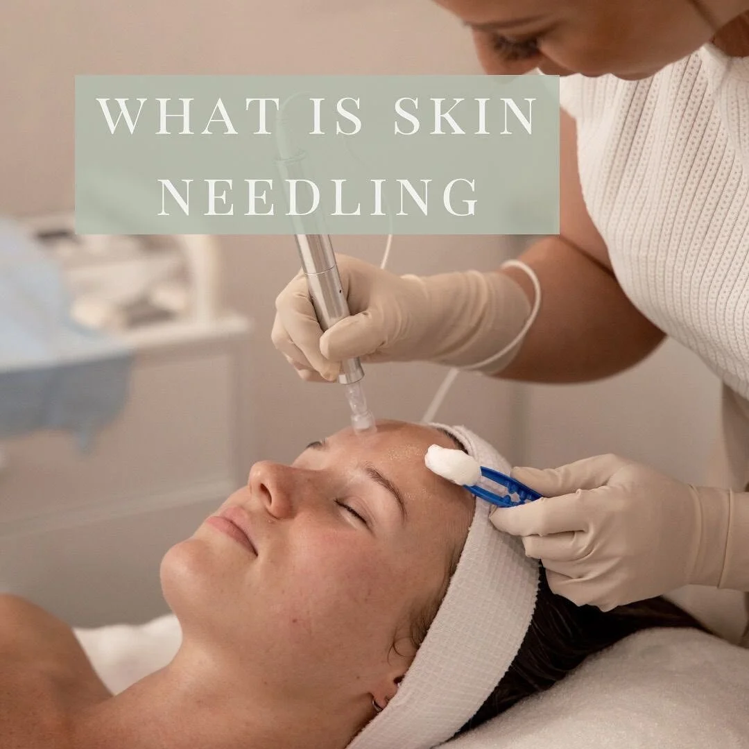 You've probably seen our exciting news - we have an incredible treatment here at Luxe Skin and Beauty 🎉
Collagen Induction Therapy AKA Skin Needling!

So, why is Skin Needling such an incredible, sought-after treatment? Read below to find out 👇

Q.