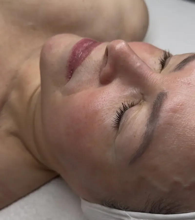 Side profile view of a client undergoing skin consultation and treatment assessment.