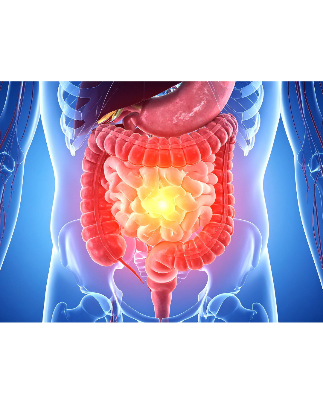 Color photograph of small and large bowel