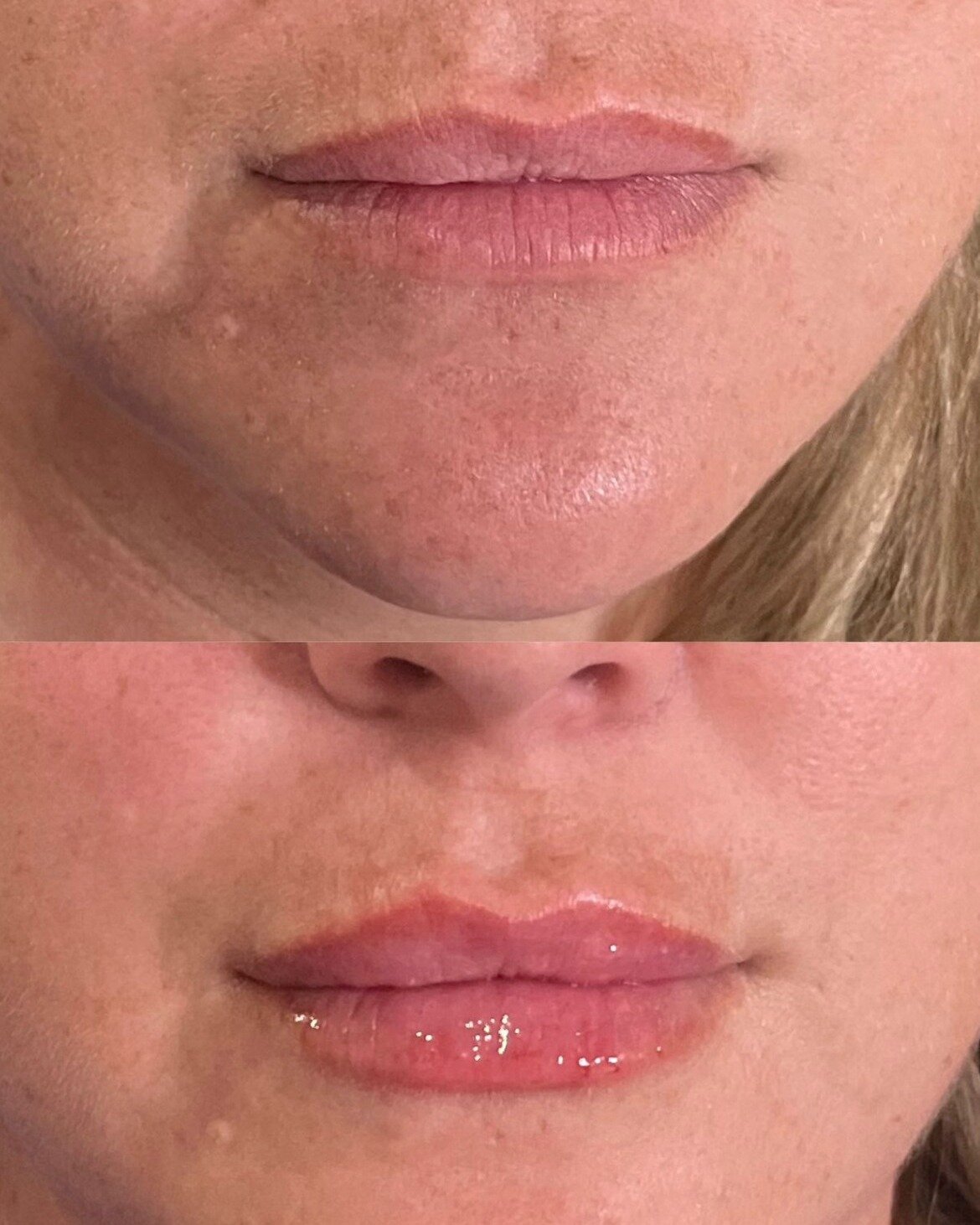 Lip Refresh - Close Up... and of course unedited. By the way at SLB we take all the photos with client upright to give a more true representation of what the lips look like in day to day life.

I mean the crisp borders on this lip, the beautiful bala