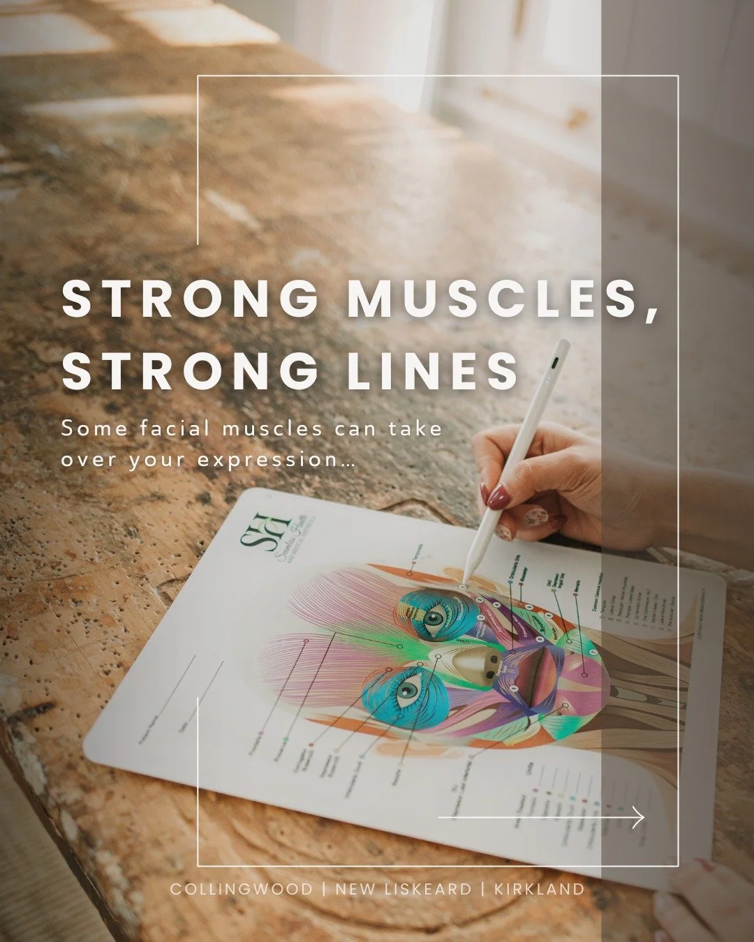 Strong facial muscles can do more than move your face; over time, they can start to shape it.

When certain muscles become overactive, they contract more frequently and with greater force, creating deeper lines or pulling your expression into a state
