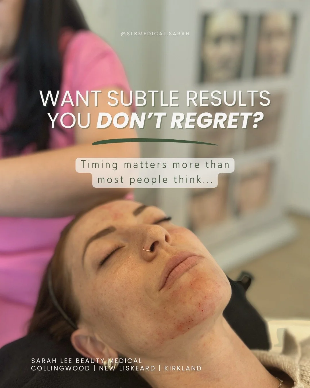 Most people don&rsquo;t regret doing aesthetic treatments before an event&hellip; they regret rushing them ✨

The best results usually come from having enough time to plan properly, let treatments settle naturally, and make subtle adjustments if need