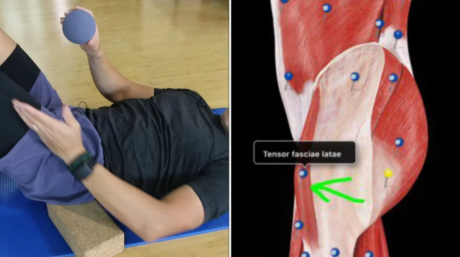 Tensor Fasciae Latae Tightness : Cause, Symptom’S, Stretching Exercise ...