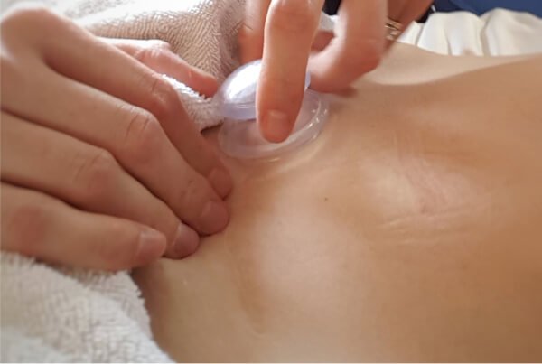 Císařovnám_baňková masáž.jpg