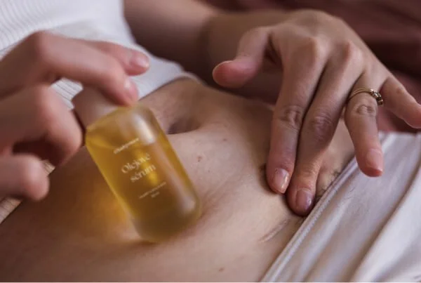 Císařovnám_mazani jizvy.jpg