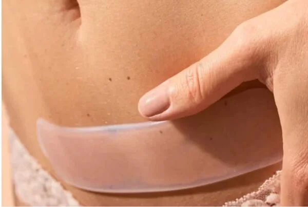 Císařovnám_silikonové pásky na jizvu.jpg