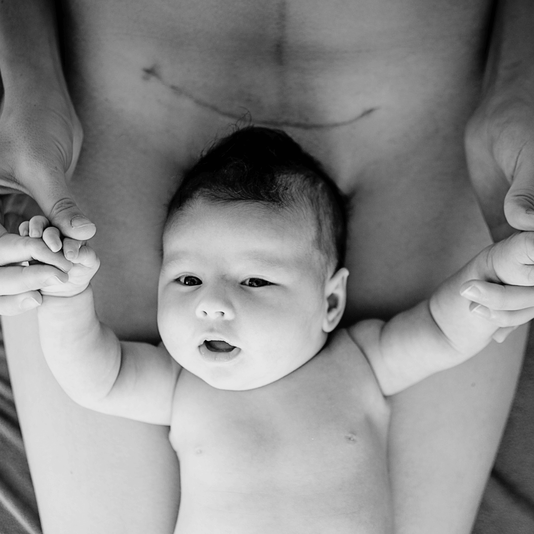 #12: An anonymous amazing, scary but breath-taking caesarean birth story…