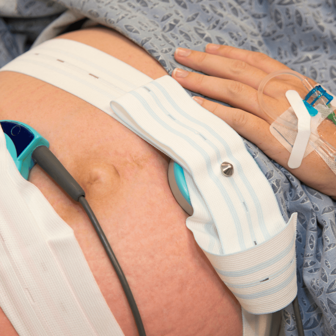 CTG monitoring during birth to check mum and baby are well