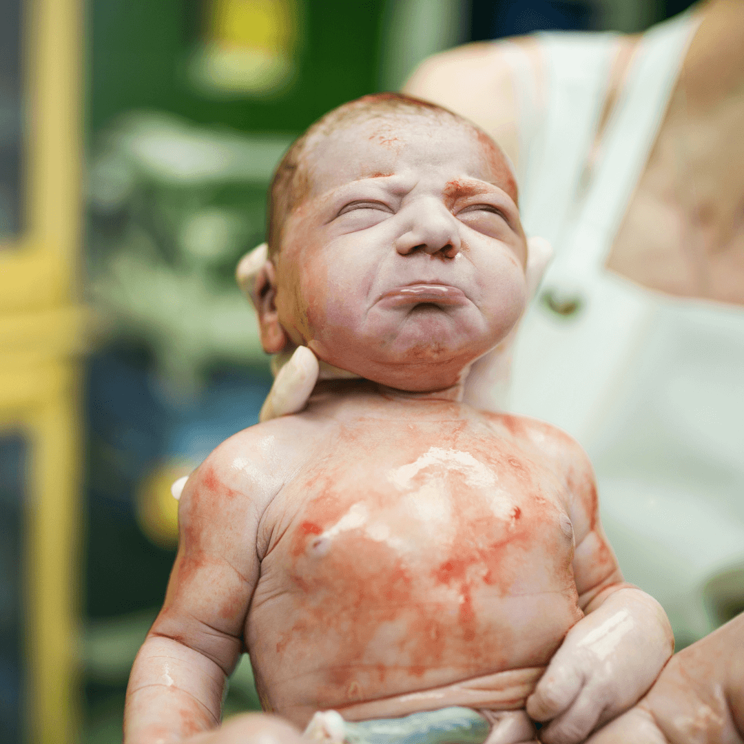 a baby is born via caesarean section and looks unhappy