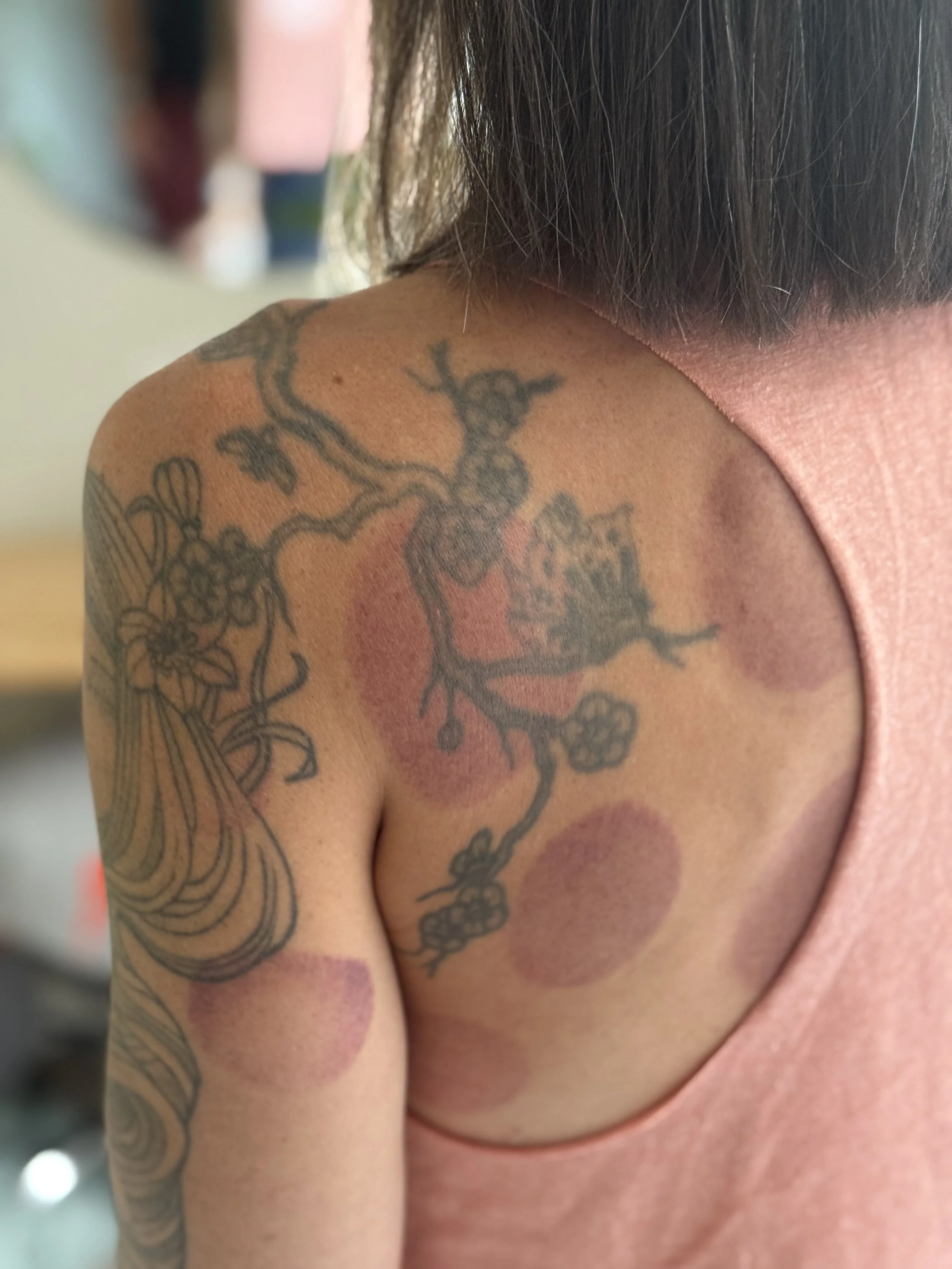 Cupping Therapy Is Coming to THE SPACE