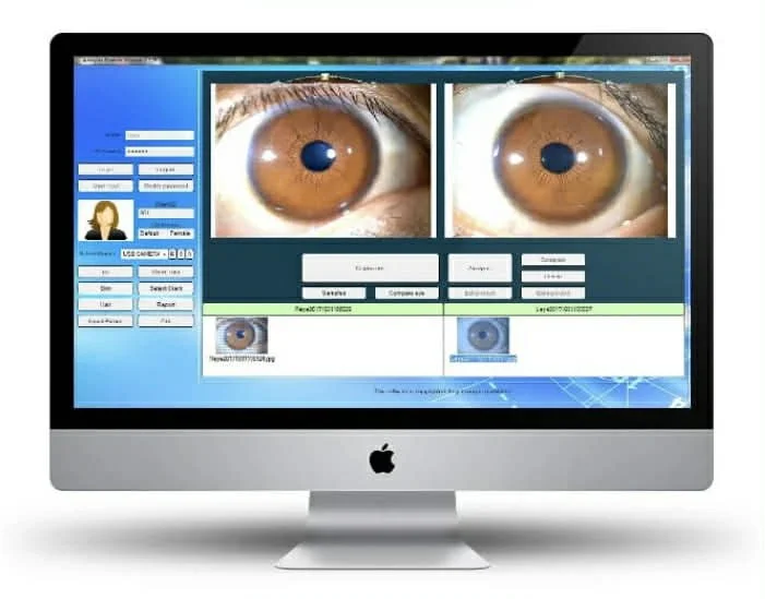 Iridology software interface used with the Maikong Iriscope 9822U displaying close-up iris images for analysis.