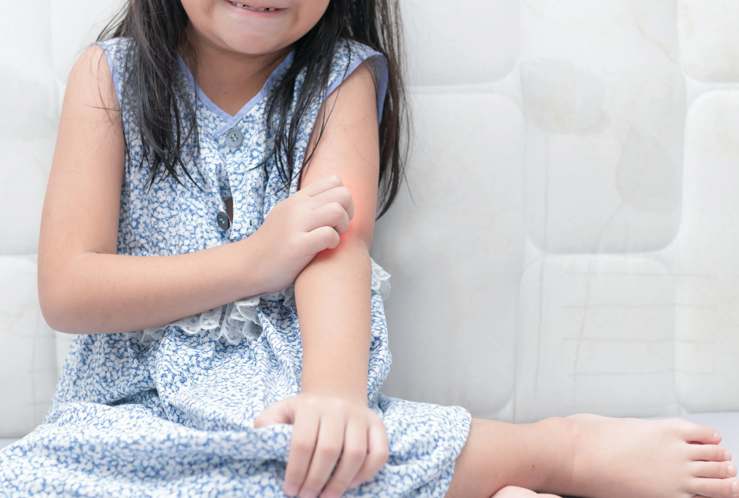 Top 3 TCM Treatments for Eczema in Children
