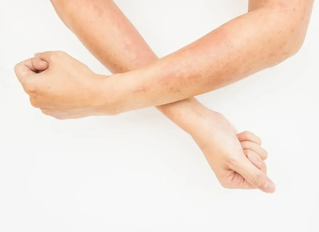 Skin Conditions.webp