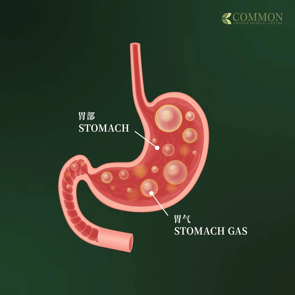 Managing Bloating with Traditional Chinese Medicine