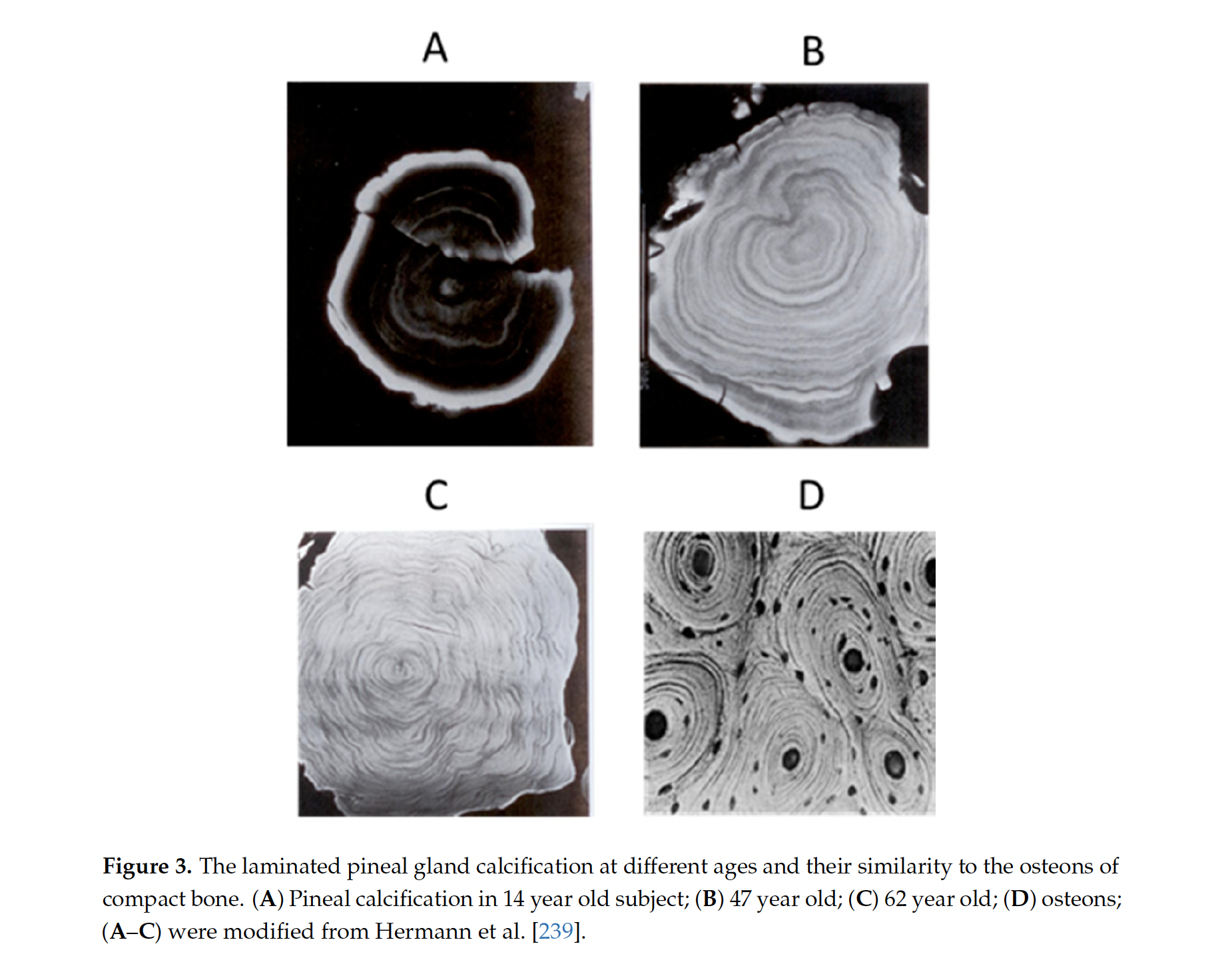   From: Pineal Calcification, Melatonin Production, Aging. Associated Health Consequences and Rejuvenation of the Pineal Gland by Dun Xian Tan, Bing Xu, Xinjia Zhou and Russel J Reiter. Published in    Molecules    January 2018  