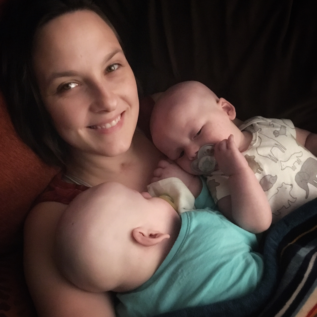Erica Stearns is pictured holding her two children, Margot and Cary. Both children have alopecia universalis caused by their shared ultra-rare genetic disease resulting from a mutation on the Lansterol Synthase (LSS) gene.