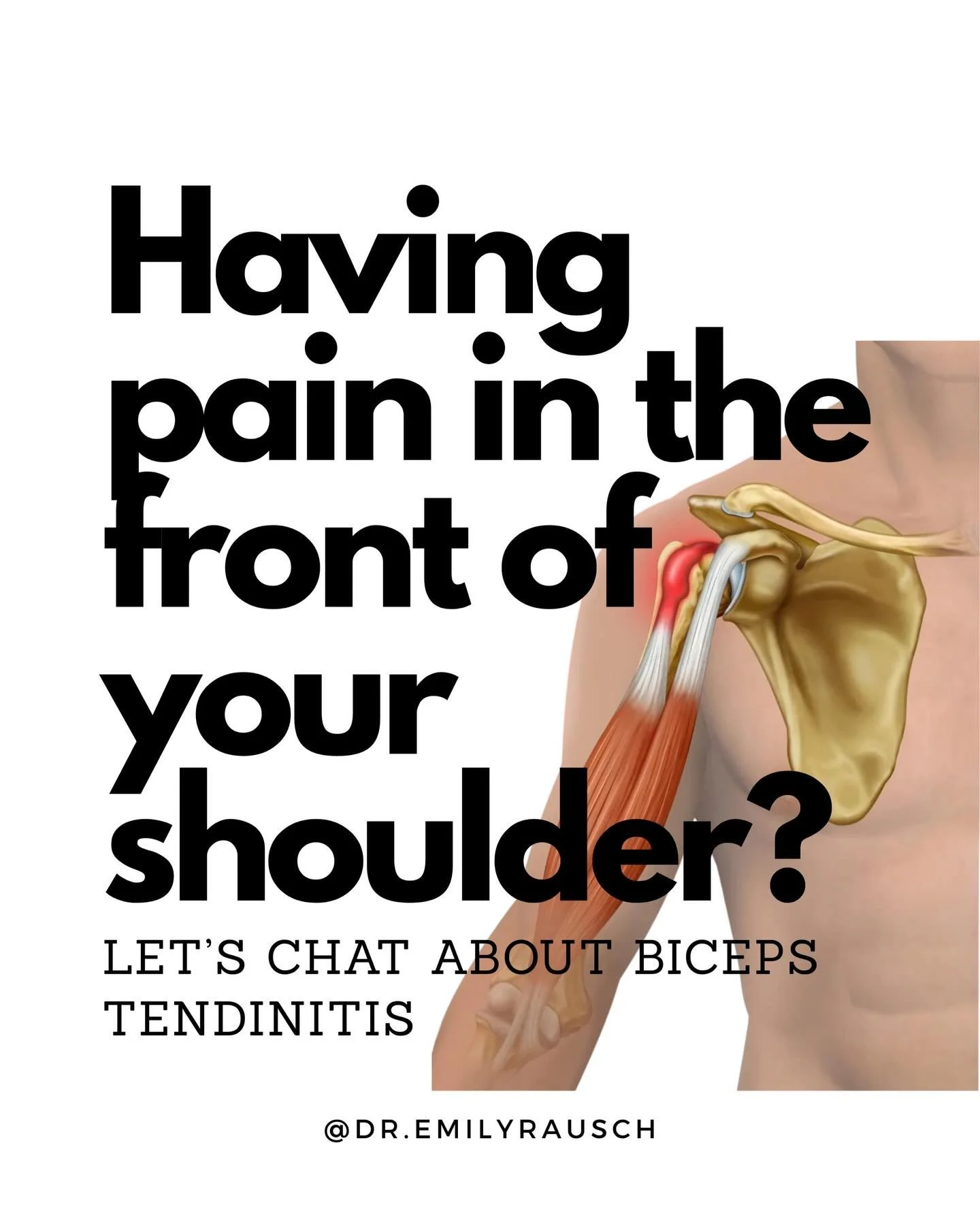 Wondering why the front part of your shoulder hurts?  Read this. 

Key takeaways:

Bicep tendon pain is often secondary to another shoulder pathology that needs to be addressed to not have this become a chronic concern. 

Tendons heal differently tha